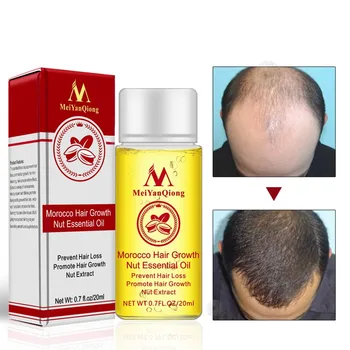 20ml Unisex Maroko Plaukų Augimą Riešutų Eterinių Aliejų, Plaukai Greičiau Auga Naftos Sustabdyti Plaukų Slinkimas Produktų Grožio Plaukų Priežiūra