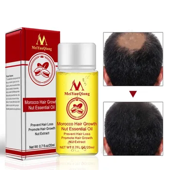 20ml Unisex Maroko Plaukų Augimą Riešutų Eterinių Aliejų, Plaukai Greičiau Auga Naftos Sustabdyti Plaukų Slinkimas Produktų Grožio Plaukų Priežiūra