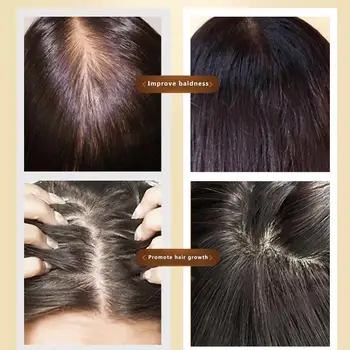 5vnt Plaukų Augimą Skystis Plaukų Augimo Gydymo priemonė-plaukų Slinkimas Maitinamasis Serumas Drėkina Remonto Plaukelių Šaknis Sveiki Plaukai